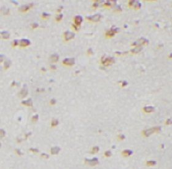 GRM2 Antibody