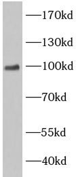 EWSR1 Antibody
