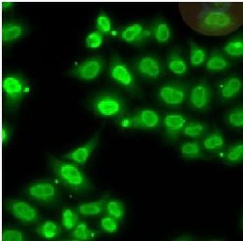 EWSR1 Antibody