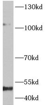 NFKB1 Mouse Monoclonal Antibody
