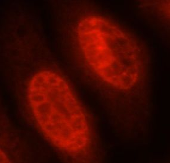 NFKB1 Mouse Monoclonal Antibody