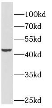 GSDMB Antibody