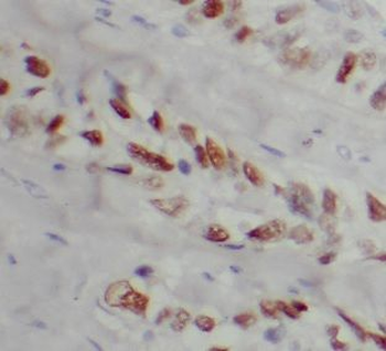 PTTG1 Antibody