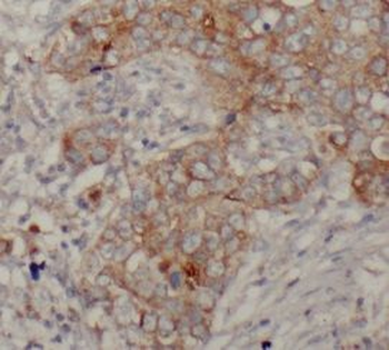 TLR8 Antibody