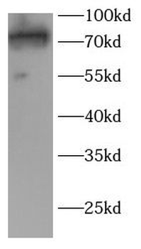 TAB2 Antibody