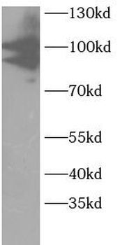 PIK3R2 Rabbit Polyclonal Antibody