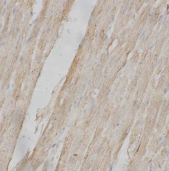 CLCN1 Antibody