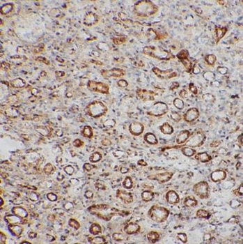 NABP2 Rabbit Polyclonal Antibody