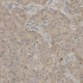TEAD1 Antibody