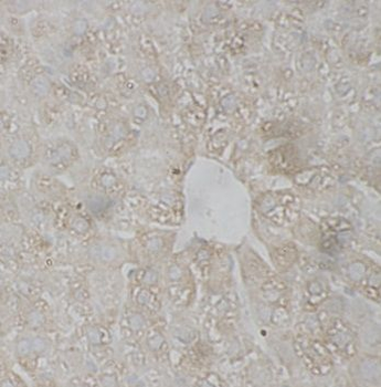 KIR2DS3 Antibody