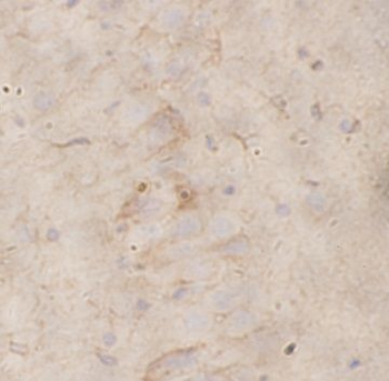 VHL Rabbit Polyclonal Antibody