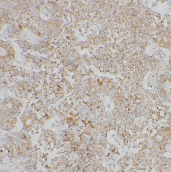 TSPAN12 Antibody