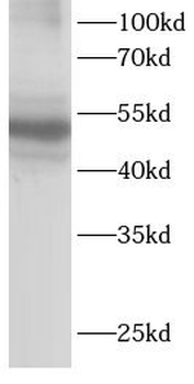 TEC Antibody
