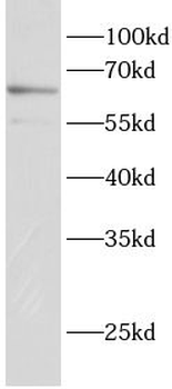 ETV6 Antibody