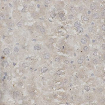 F5 Rabbit Polyclonal Antibody