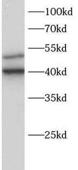 SLA Antibody