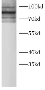 RPS6KA1 Rabbit Polyclonal Antibody