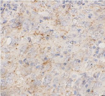 RPS6KA1 Rabbit Polyclonal Antibody