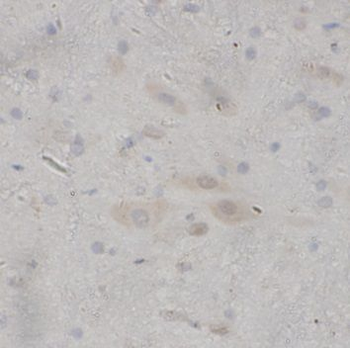NEUROD1 Rabbit Polyclonal Antibody