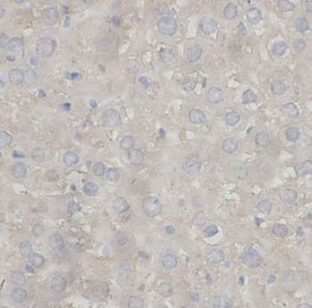 Complement C2 Rabbit Polyclonal Antibody