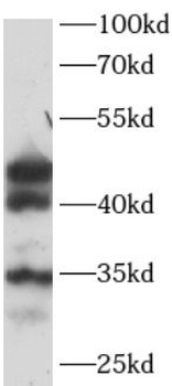 SHBG Antibody