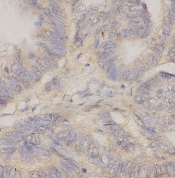 BACE2 Rabbit Polyclonal Antibody