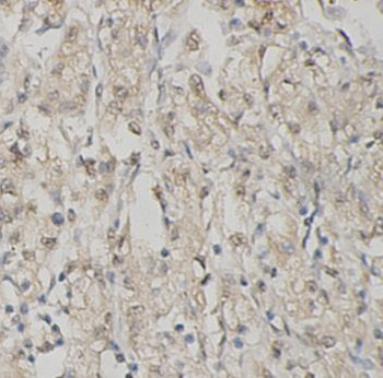 SIRT6 Antibody