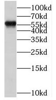 ESR2 Rabbit Polyclonal Antibody