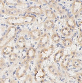 ESR2 Rabbit Polyclonal Antibody