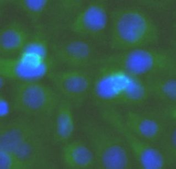 TOLLIP Antibody