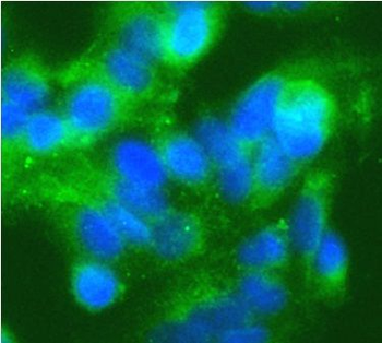 IRAK4 Antibody