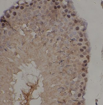 IRAK4 Antibody