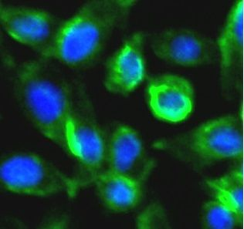 RIPK1 Antibody