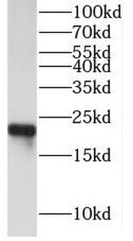 CYGB Antibody