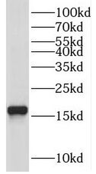 UBE2N Antibody