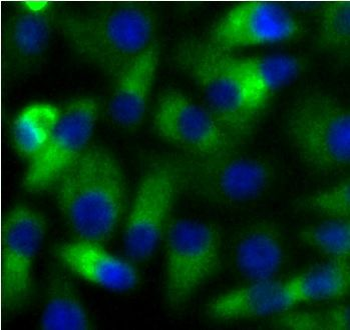 UBE2N Antibody