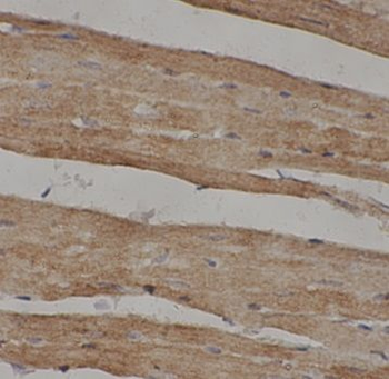 UBE2N Antibody