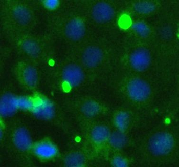 TRAM1 Antibody