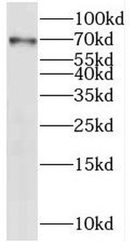 IRAK2 Antibody