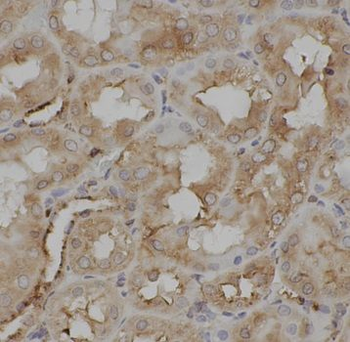 IRAK2 Antibody
