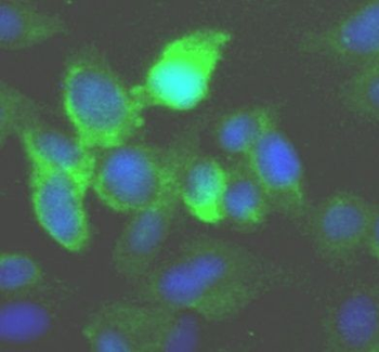 IKBKE Antibody