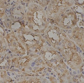 IKBKE Antibody