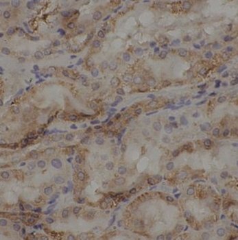 MAPK8 Rabbit Polyclonal Antibody
