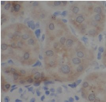 MAP2K2 Rabbit Polyclonal Antibody
