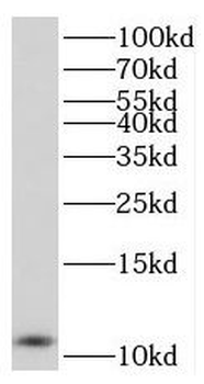 SUMO1 Rabbit Polyclonal Antibody