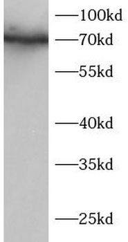 IRAK1 Rabbit Polyclonal Antibody