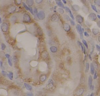 IRAK1 Rabbit Polyclonal Antibody