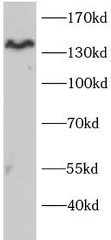 INPPL1 Antibody