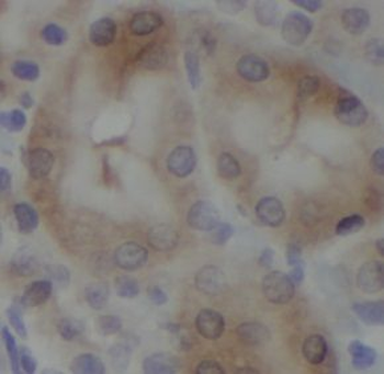 PTPN1 Antibody