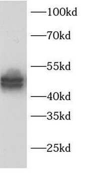 IKBKG Rabbit Polyclonal Antibody